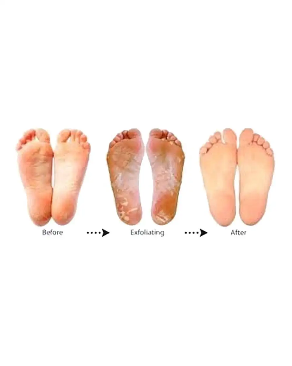 מסיכת פילינג לרגליים של Purederm 3
