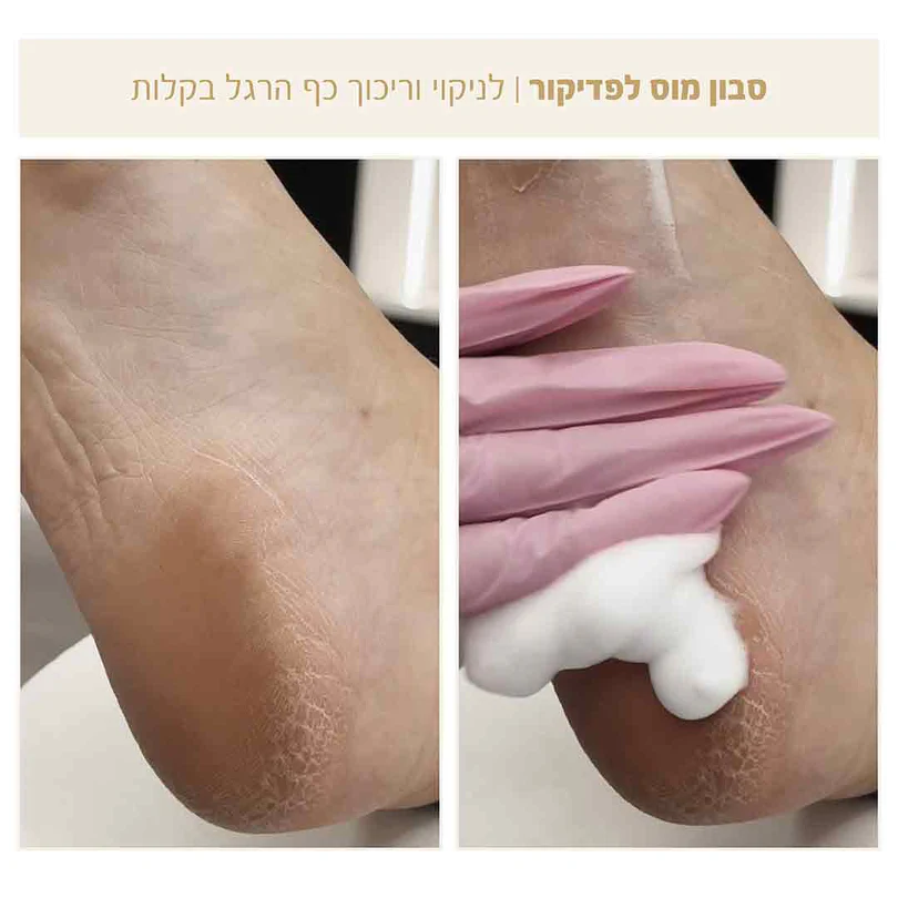 מוס סבון לטיפול בכפות הרגליים 2