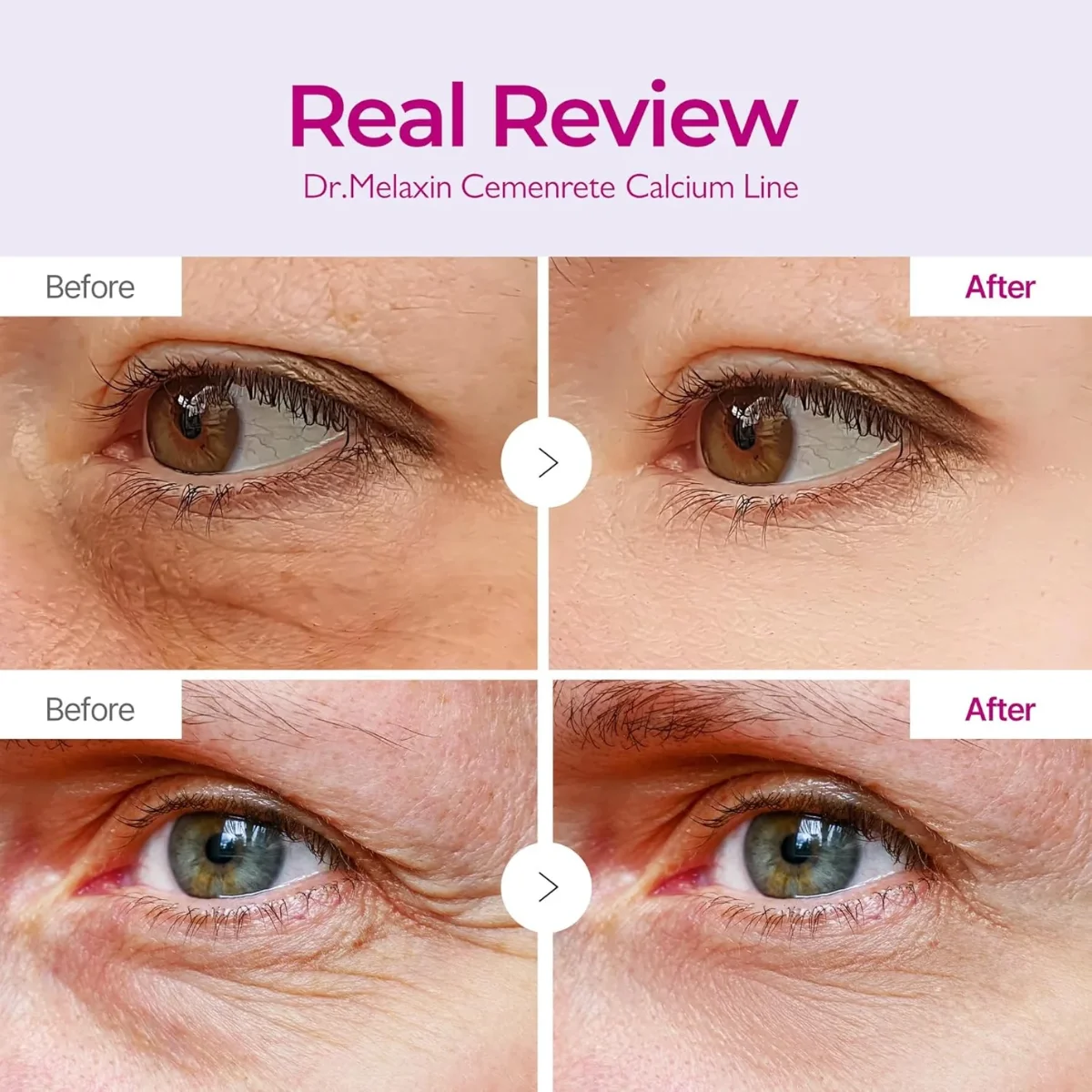 כתמי עיניים ד. Melaxen Cementerate Calcium Volume - 60 מדבקות 5