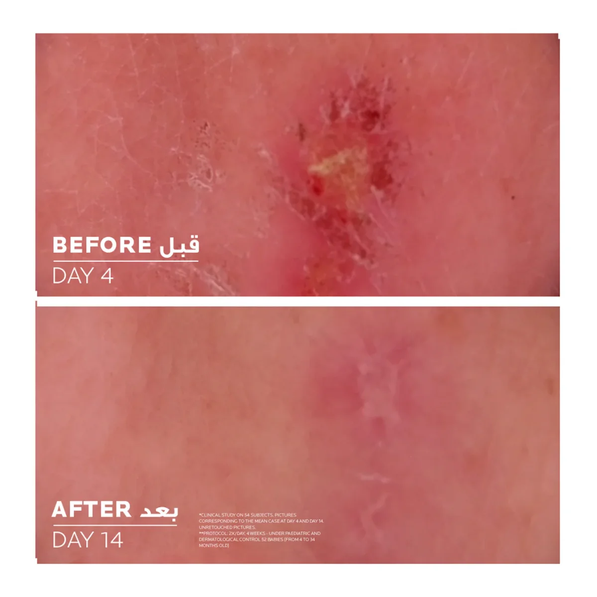 La Roche-Posay Cicaplast Bum B5+ באלם מרגיע ולחות 100 מ"ל 7